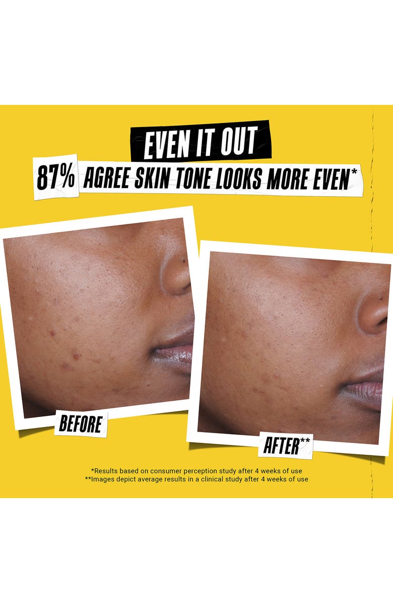 Kiehl's Since 1851 Better Screen<sup>™</sup> UV Serum Broad Spectrum SPF 50+, Alternate, color,