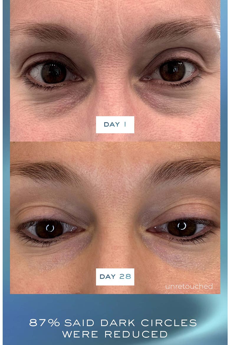 The Face & Eye Transformation Set $750 Value, Alternate, color, NO COLOR