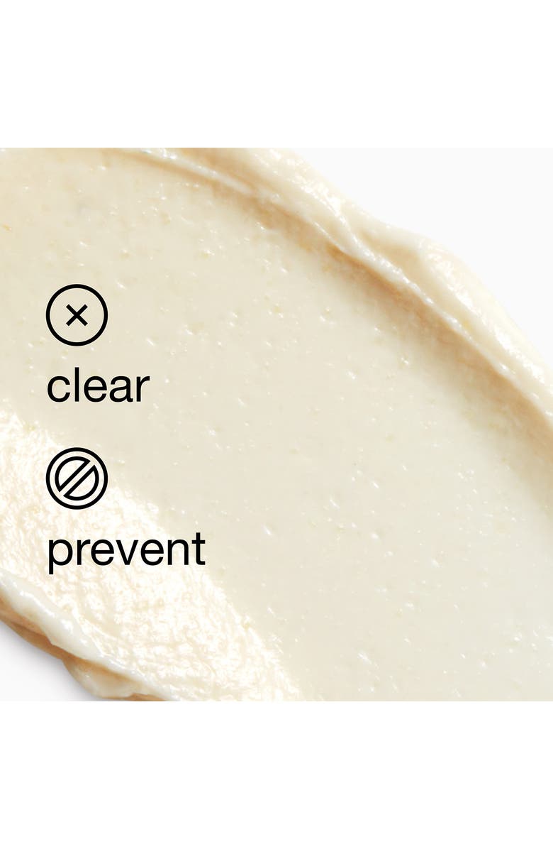 Clinique Blackhead Solutions Self-Heating Blackhead Extractor, Alternate, color, 