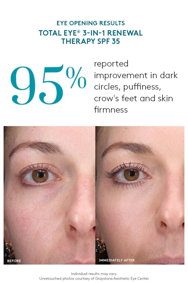 ® Total Eye 3-in-1 Renewal Therapy Broad Spectrum SPF 35 Concealer, Alternate, color, DEEP
