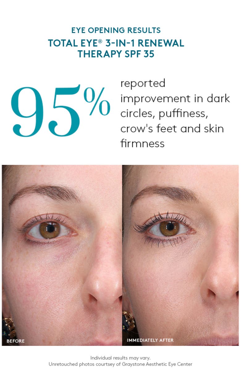 Colorescience <sup
®</sup
Total Eye 3-in-1 Renewal Therapy Broad Spectrum SPF 35 Concealer, Alternate, color, Medium