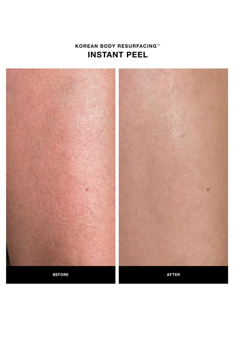 Instant Peel, Alternate, color, FRAGRANCE-FREE