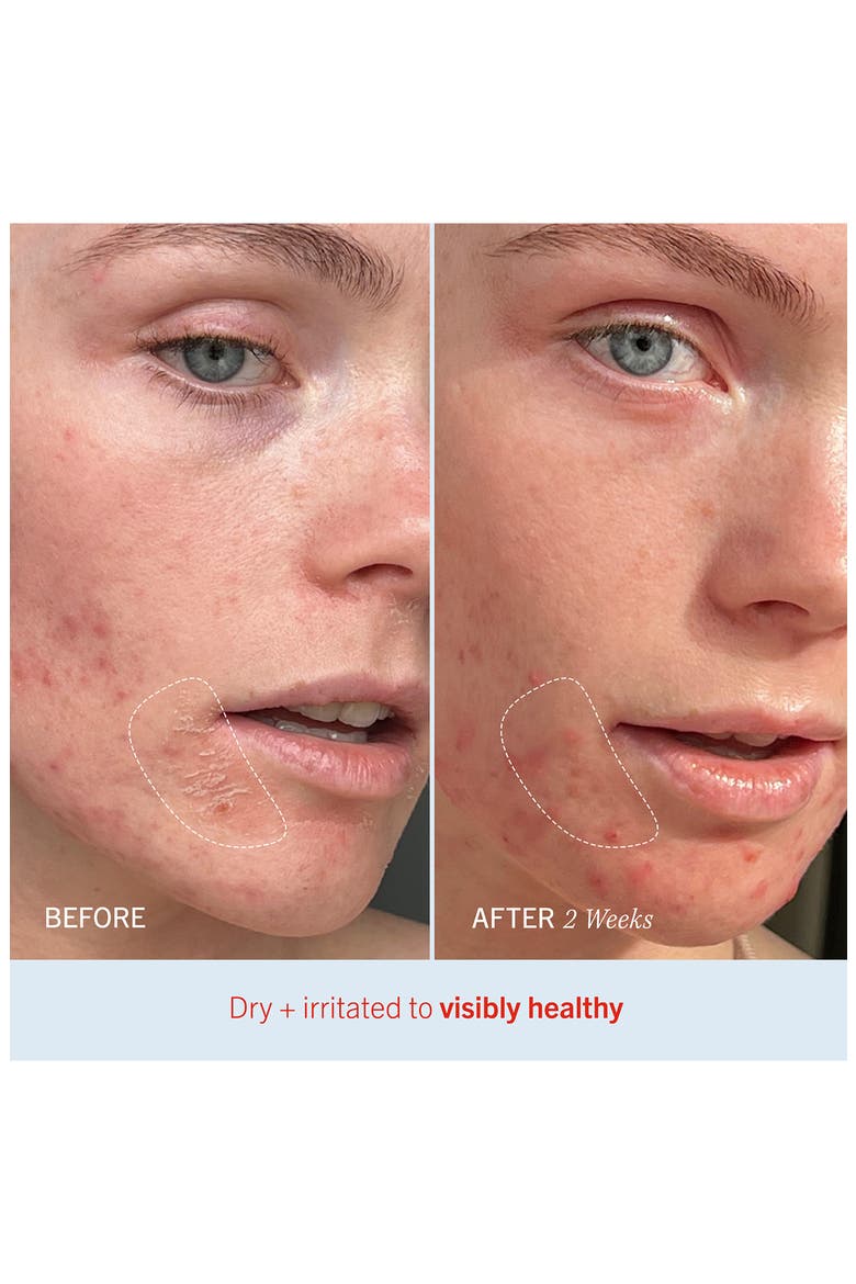 Ultra Repair Cream Intense Hydration Face & Body Moisturizer, Alternate, color, NO COLOR