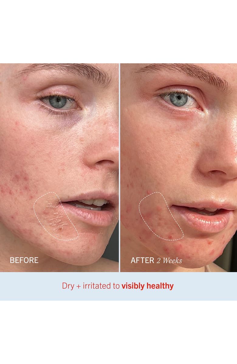 Ultra Repair Cream Intense Hydration Face & Body Moisturizer