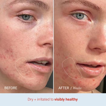 Ultra Repair Cream Intense Hydration Face & Body Moisturizer
