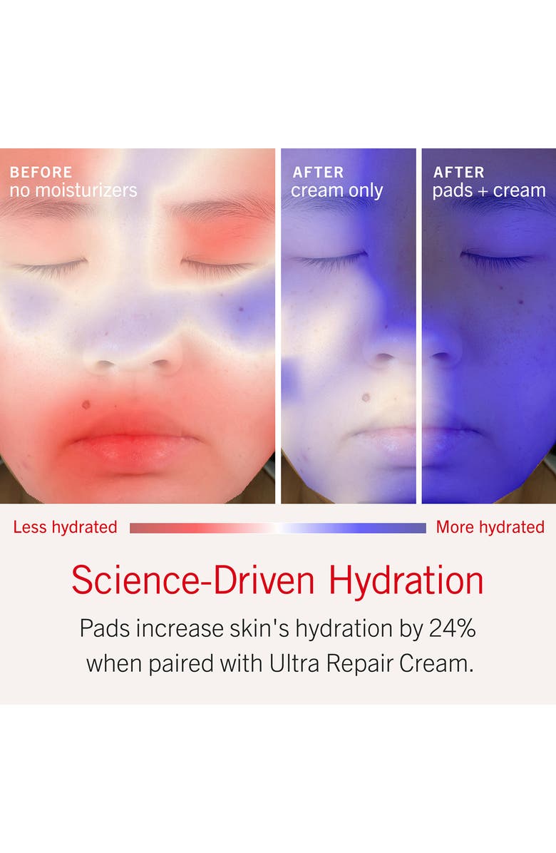 First Aid Beauty Ultra Repair Hydrating Pillow Pads, Alternate, color,