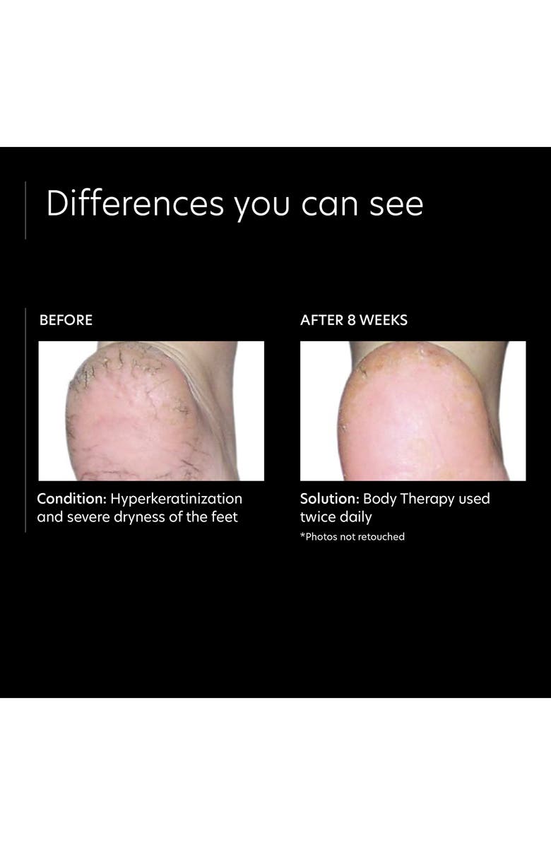 PCA Skin Body Therapy Moisturizer, Alternate, color, 