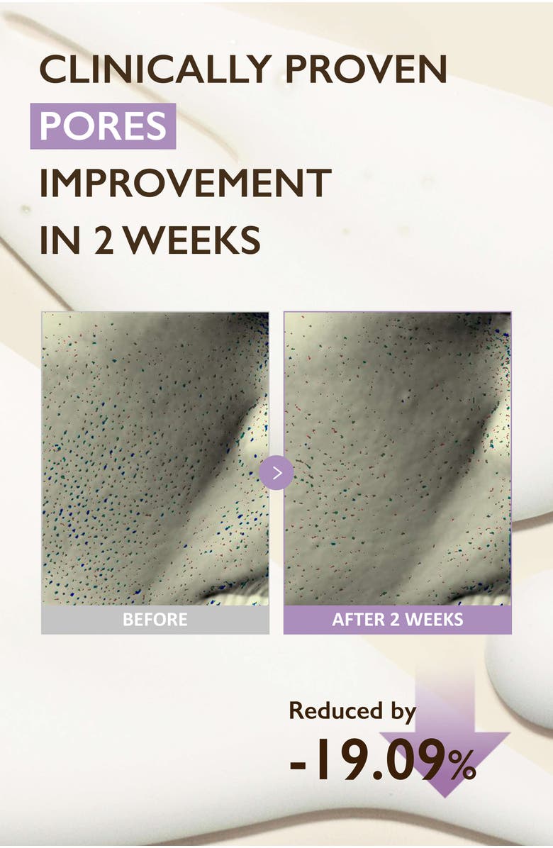 haruharu wonder Black Rice Night Knight Retinol Serum, Alternate, color, NO COLOR