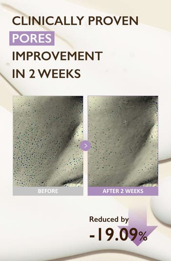 Black Rice Night Knight Retinol Serum