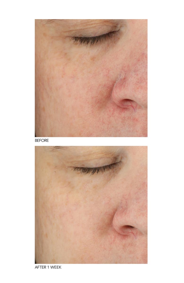 Dr. Dennis Gross Skincare B3 Adaptive Superfoods<sup>™</sup> Stress Rescue Super Serum, Alternate, color, 