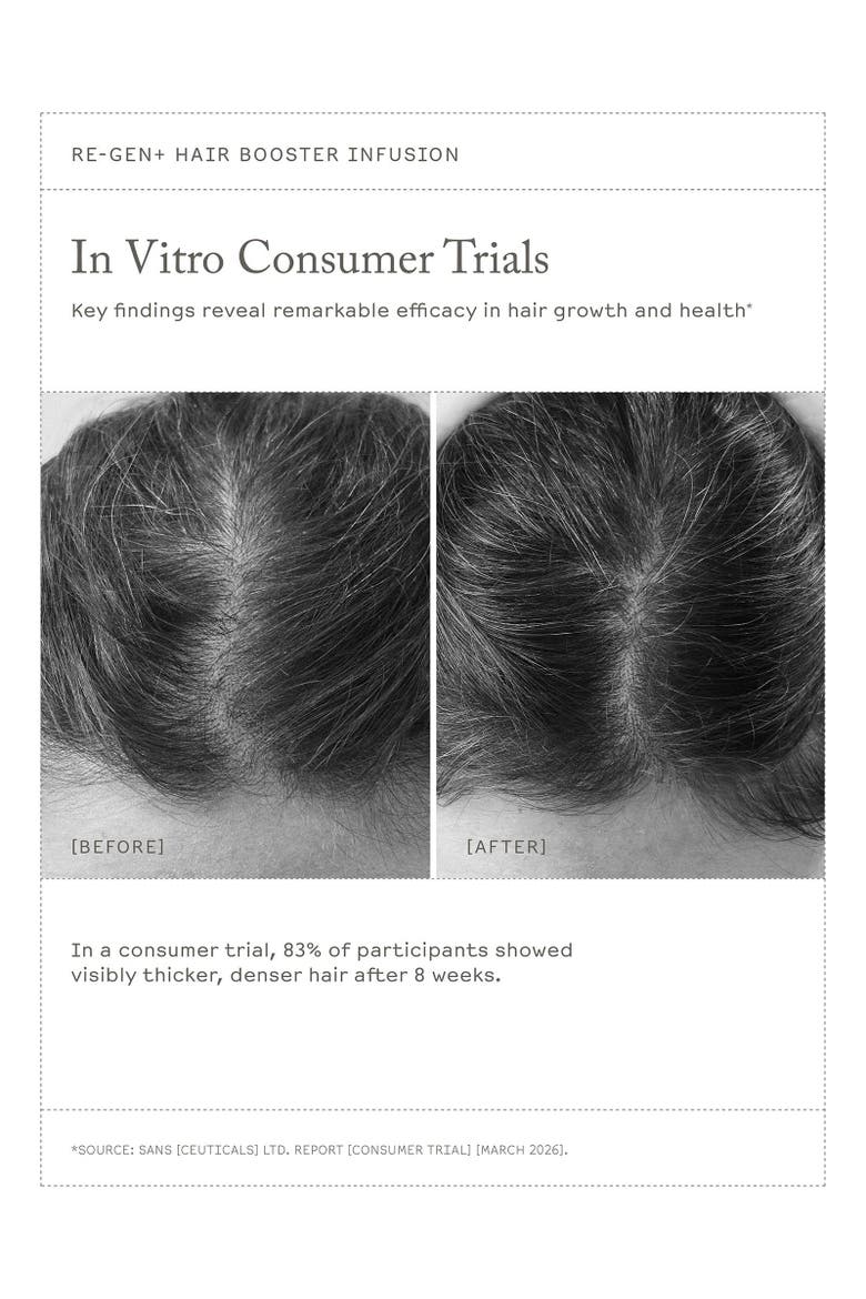 Re-Gen+ Hair Booster Infusion, Alternate, color, 100ml
