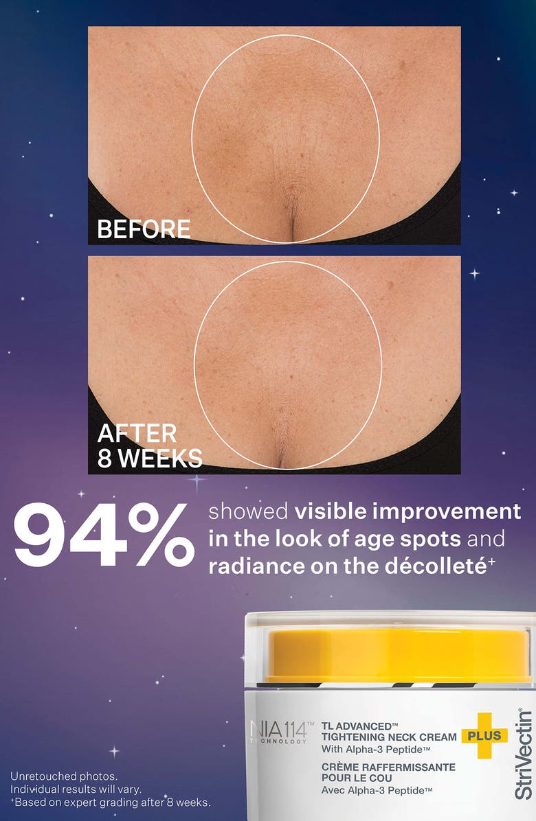 StriVectin<sup>®</sup> Tight & Sculpt Holiday Skin Care Set (Limited Edition) $198 Value, Alternate, color, 