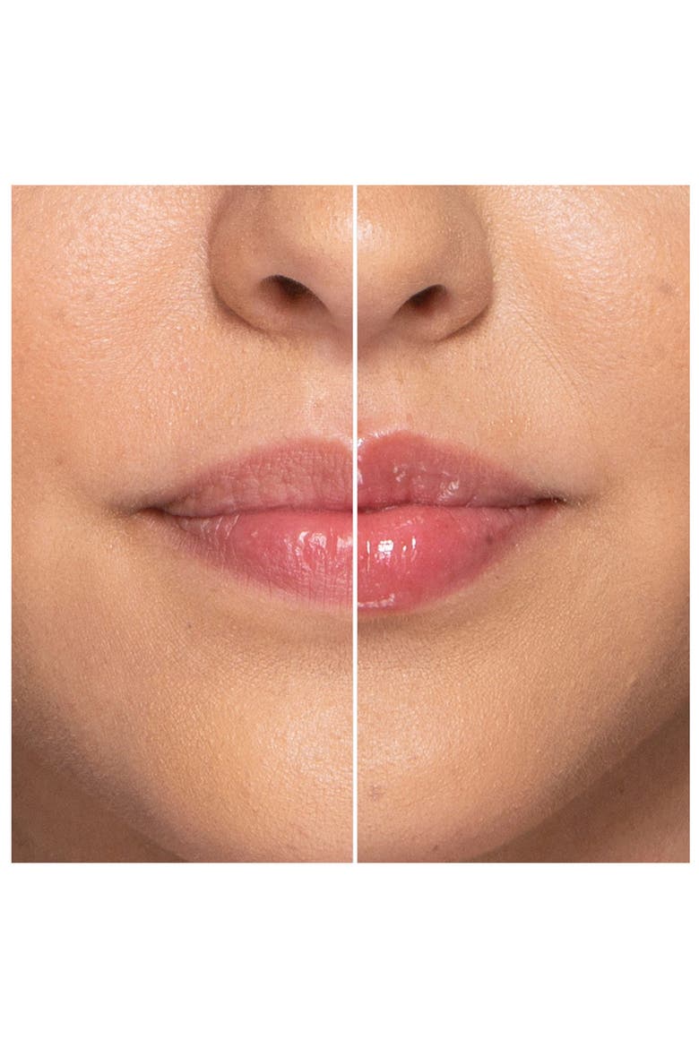 Lip Injection The Icons Set USD $33 Value, Alternate, color, NO COLOR