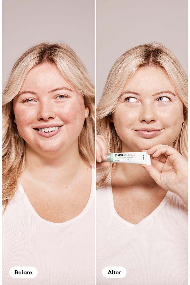 Rescue Balm +Red Correct, Alternate, color, NO COLOR