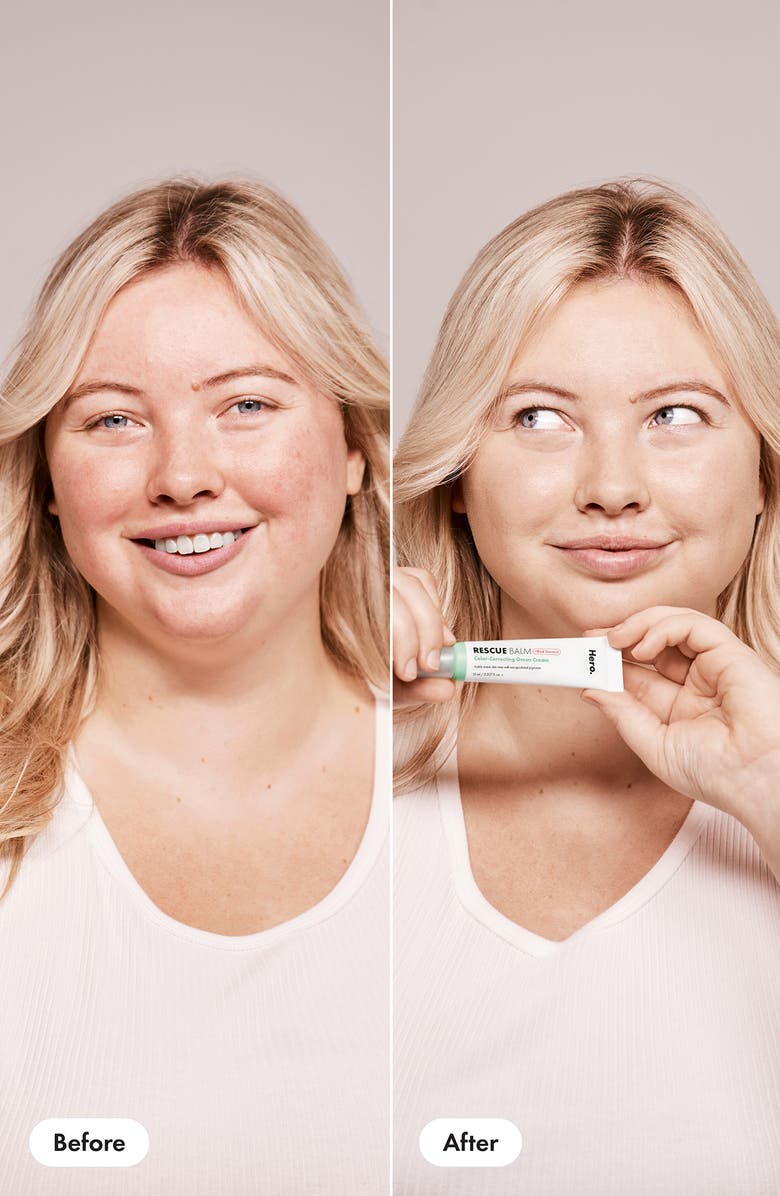 Hero Rescue Balm +Red Correct, Alternate, color,