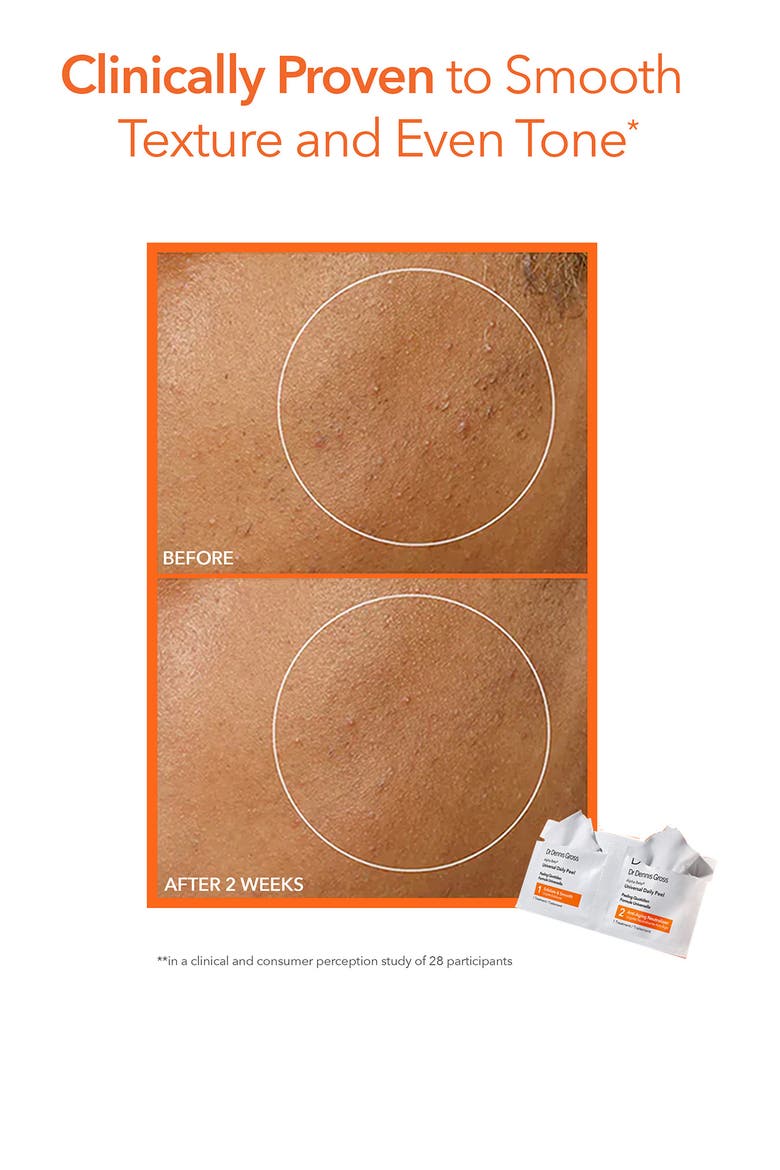 Alpha Beta® Peel Vault Set, Alternate, color, NO COLOR