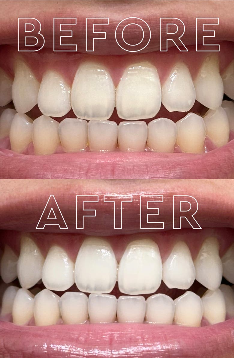 MOON Purple Color Corrector Toothpaste, Alternate, color, 