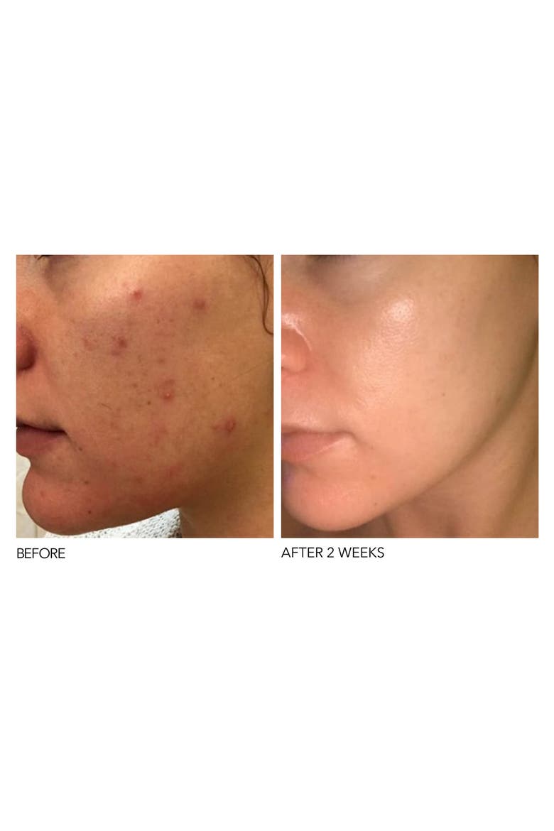 Alpha Beta® Peel Extra Strength Formula, Alternate, color, NO COLOR