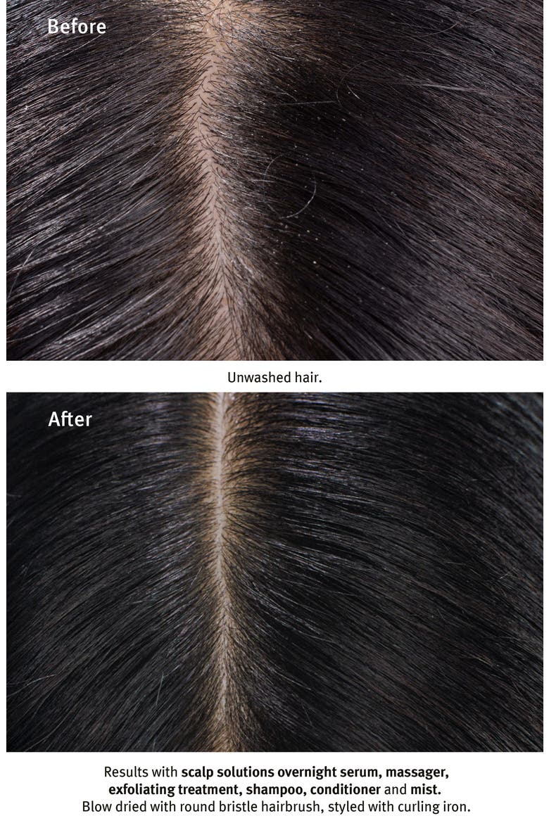 Scalp Solutions Refreshing Protective Mist, Alternate, color, NO COLOR