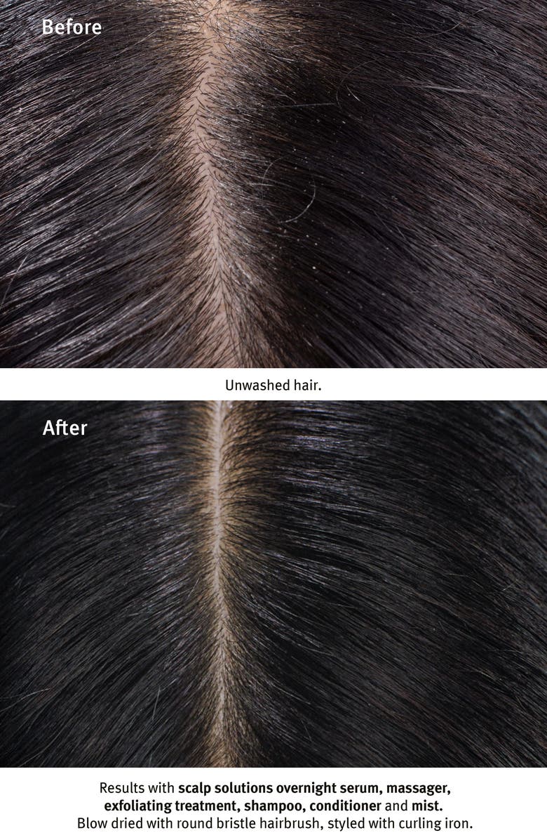 Aveda Scalp Solutions Refreshing Protective Mist, Alternate, color, 