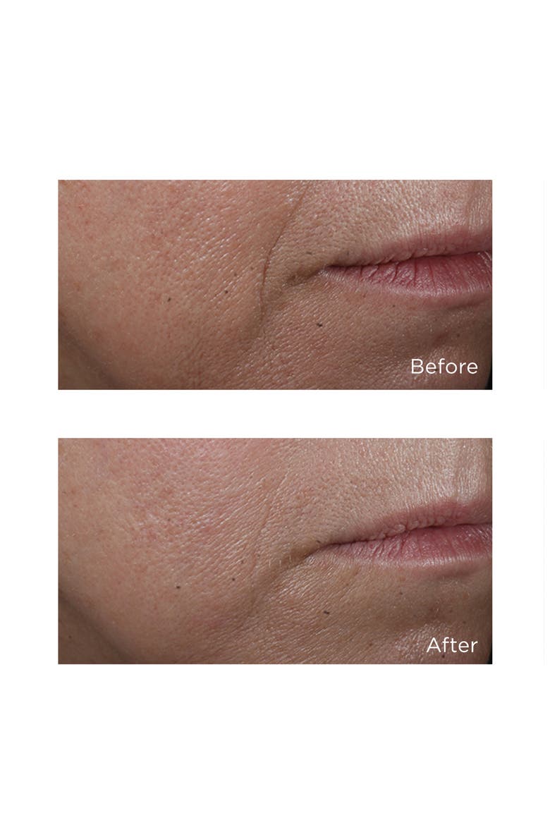 Cold Plasma Plus+ Advanced Serum Concentrate, Alternate, color, NO COLOR