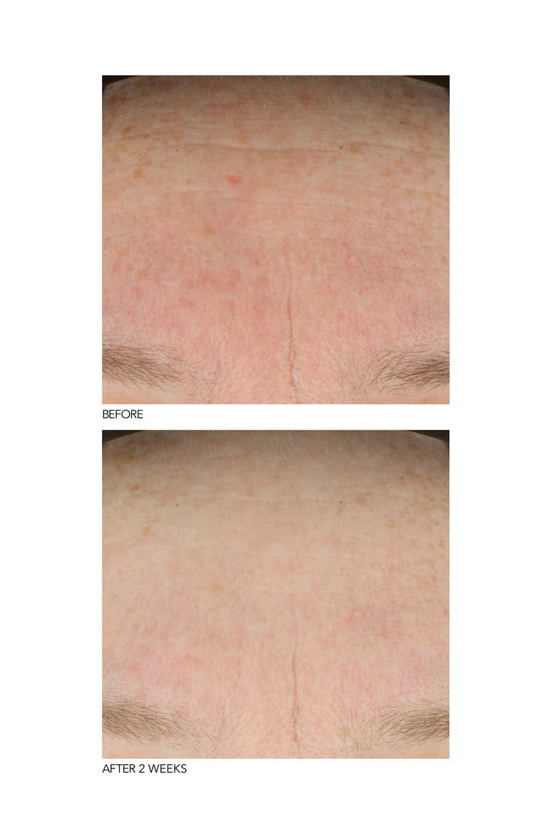 B3 Adaptive Superfoods™ Stress Rescue Super Serum, Alternate, color, NO COLOR