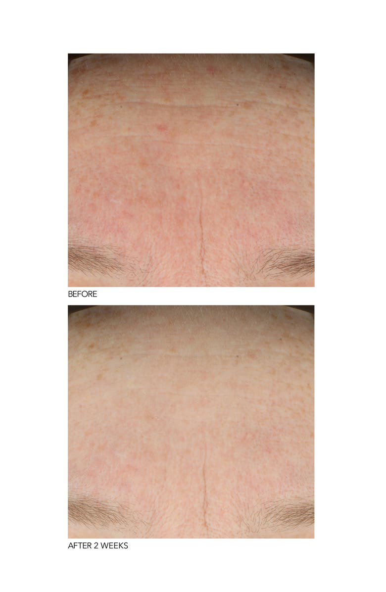 Dr. Dennis Gross Skincare B3 Adaptive Superfoods<sup>™</sup> Stress Rescue Super Serum, Alternate, color, 