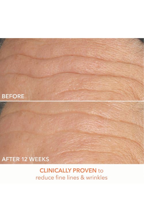 Dr Dennis Gross Skincare Dr. Dennis Gross Skincare Alpha Beta® Peel Original Formula In Transparent