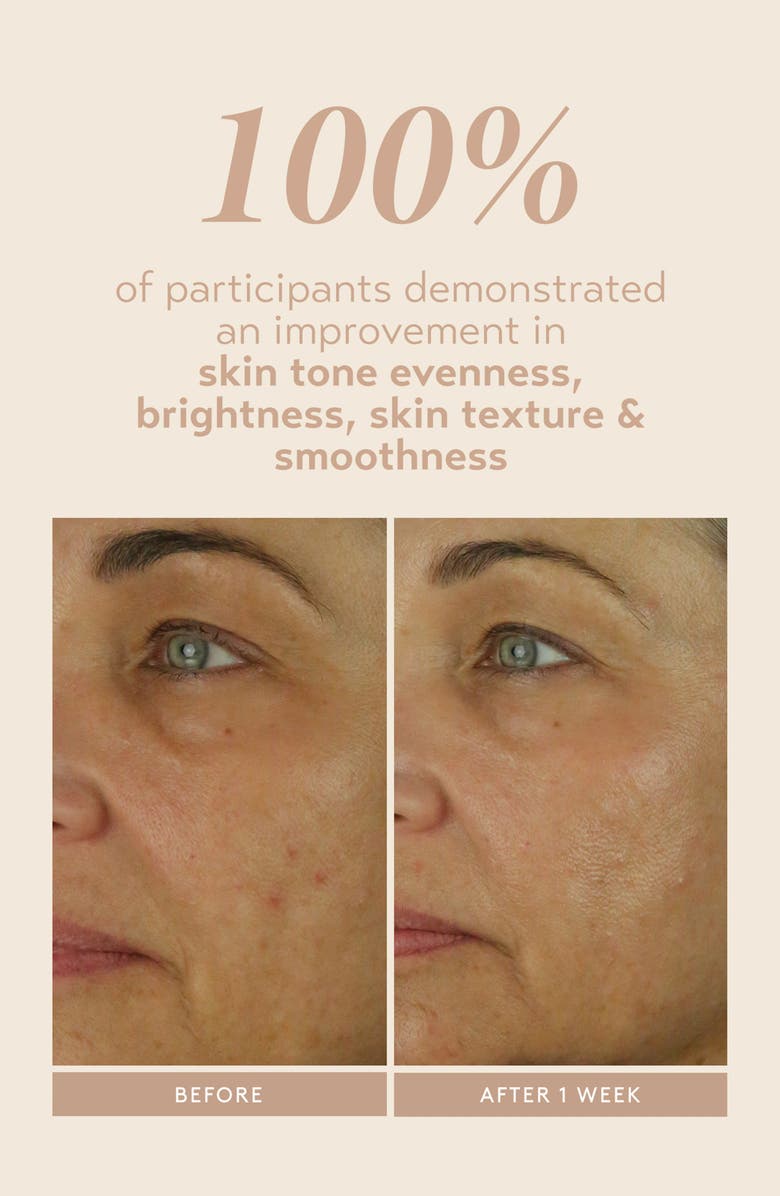 Shani Darden Skincare Retinol Reform Serum with 1% Encapsulated Retinol, Alternate, color, 