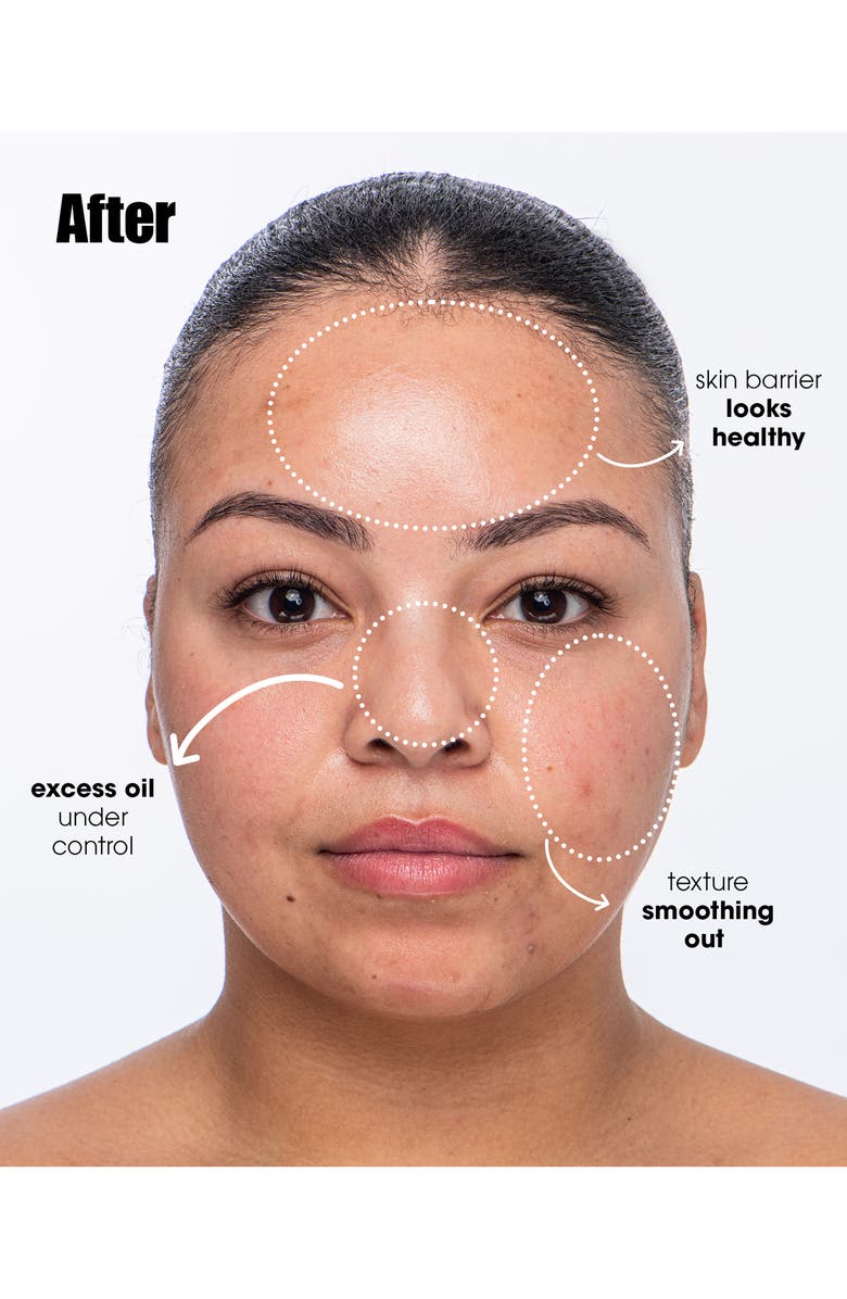 Sunday Riley Breakout Breakup Purifying Salicylic Acid Cleanser, Alternate, color, 