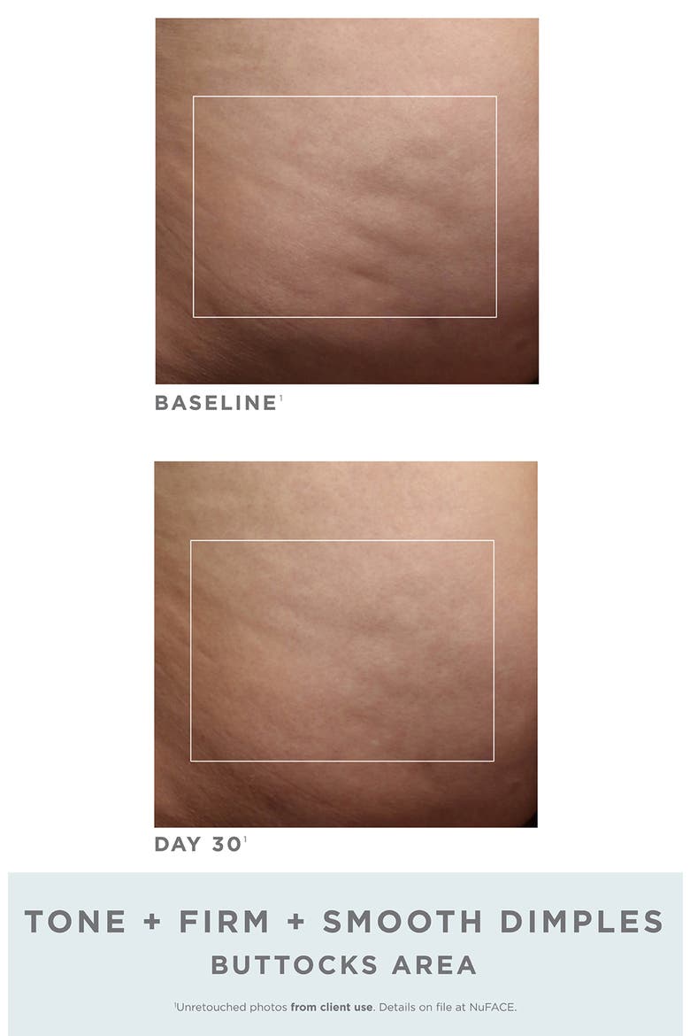 NuBODY Skin Toning Device Challenge Set (Limited Edition), Alternate, color, NO COLOR