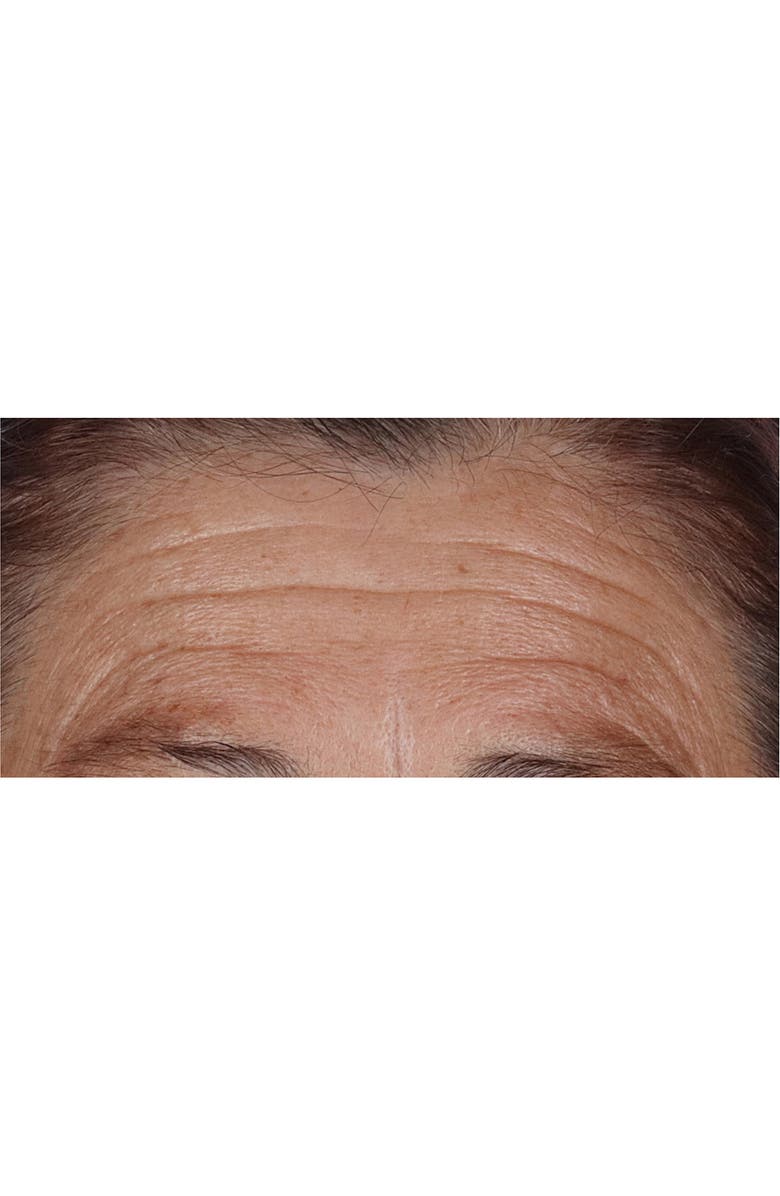 Perricone MD High Potency Hyaluronic Intensive Hydrating Serum, Alternate, color,