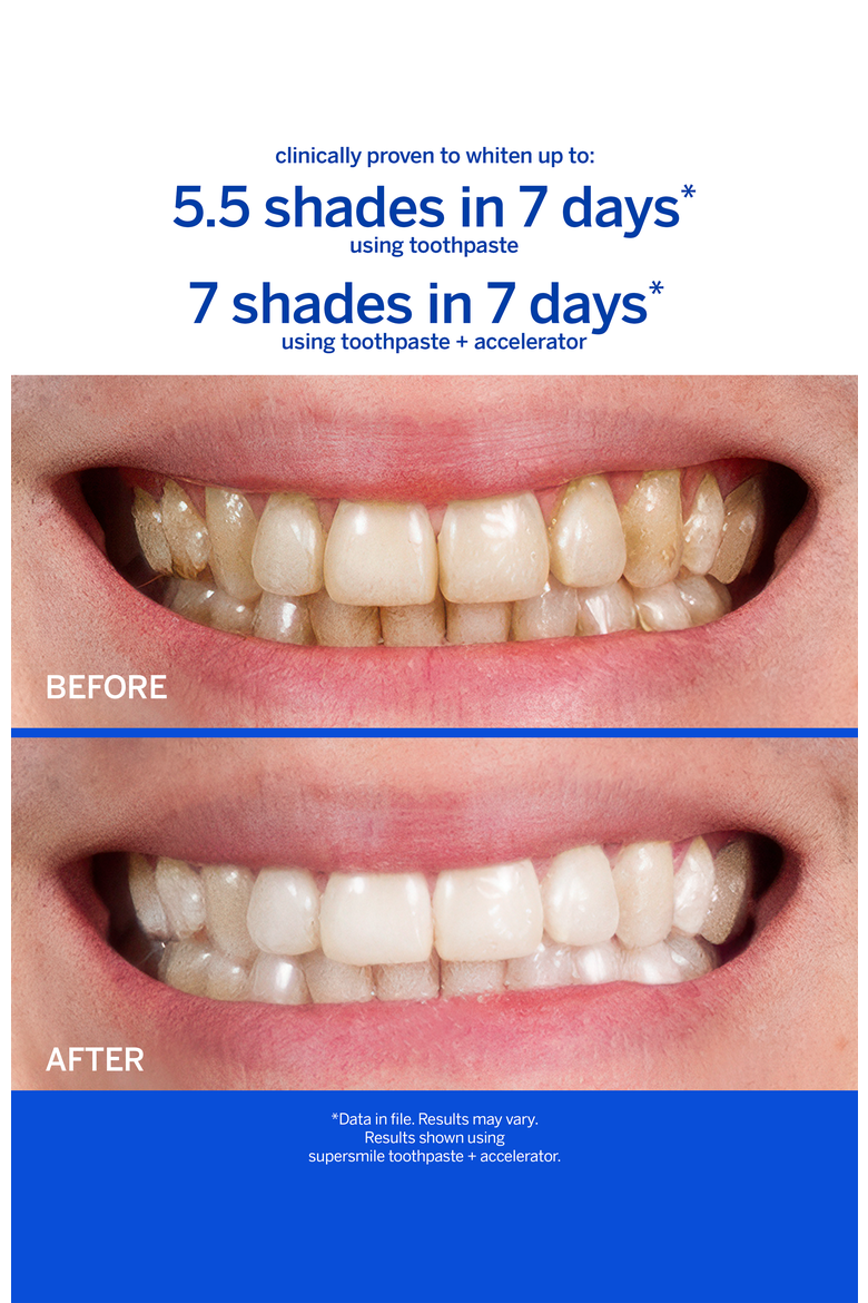 Fluoride Free Professional Whitening System - Small, Alternate, color, White