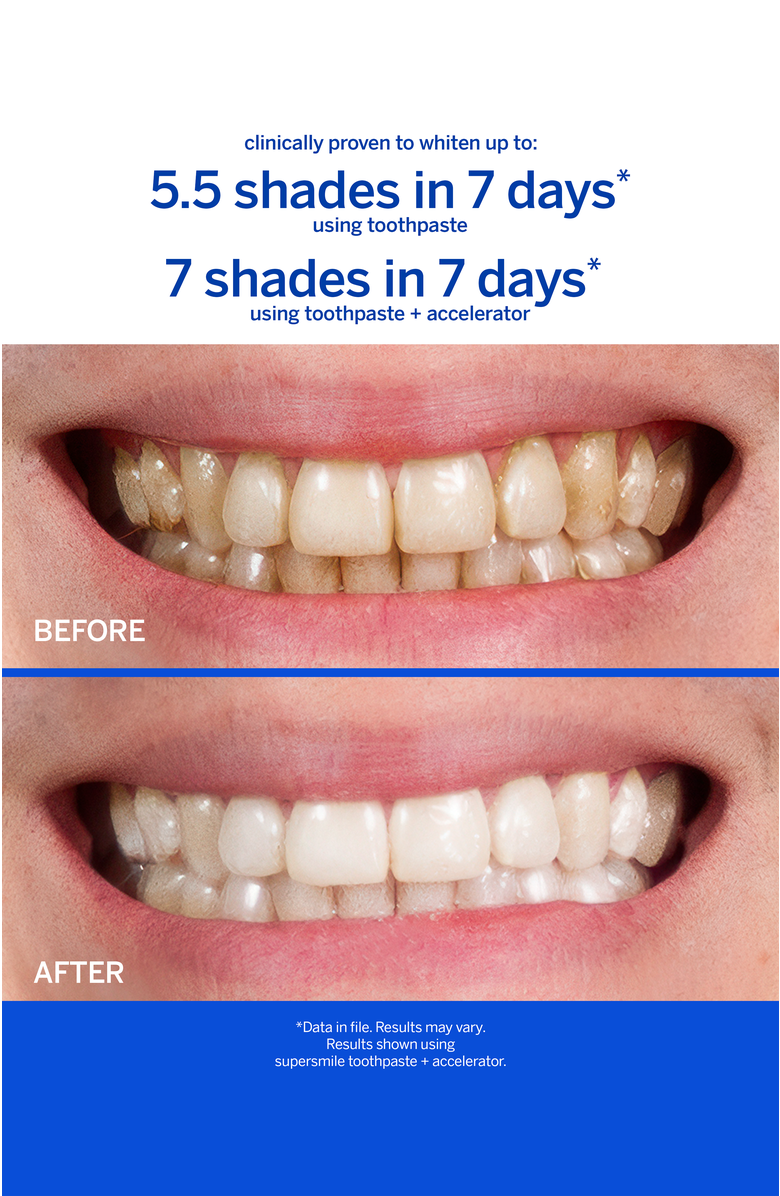 Supersmile Fluoride Free Professional Whitening System - Small, Alternate, color, White