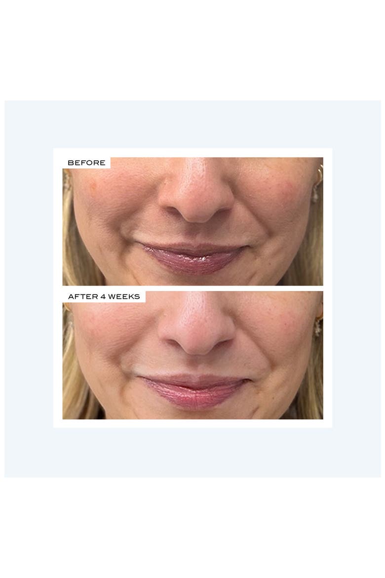 Precision Peel, Alternate, color, NO COLOR