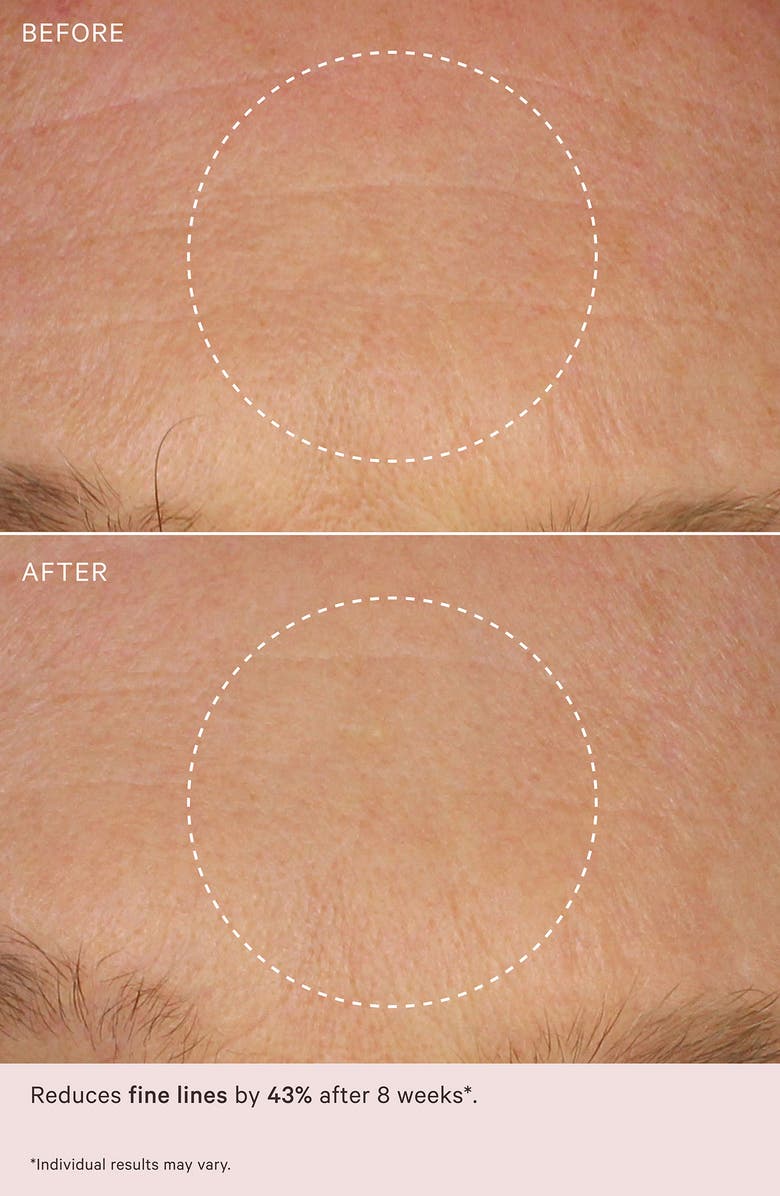 MZ Skin Retinol Skin Booster 2% Encapsulated Vitamin A Resurfacing Treatment, Alternate, color, 