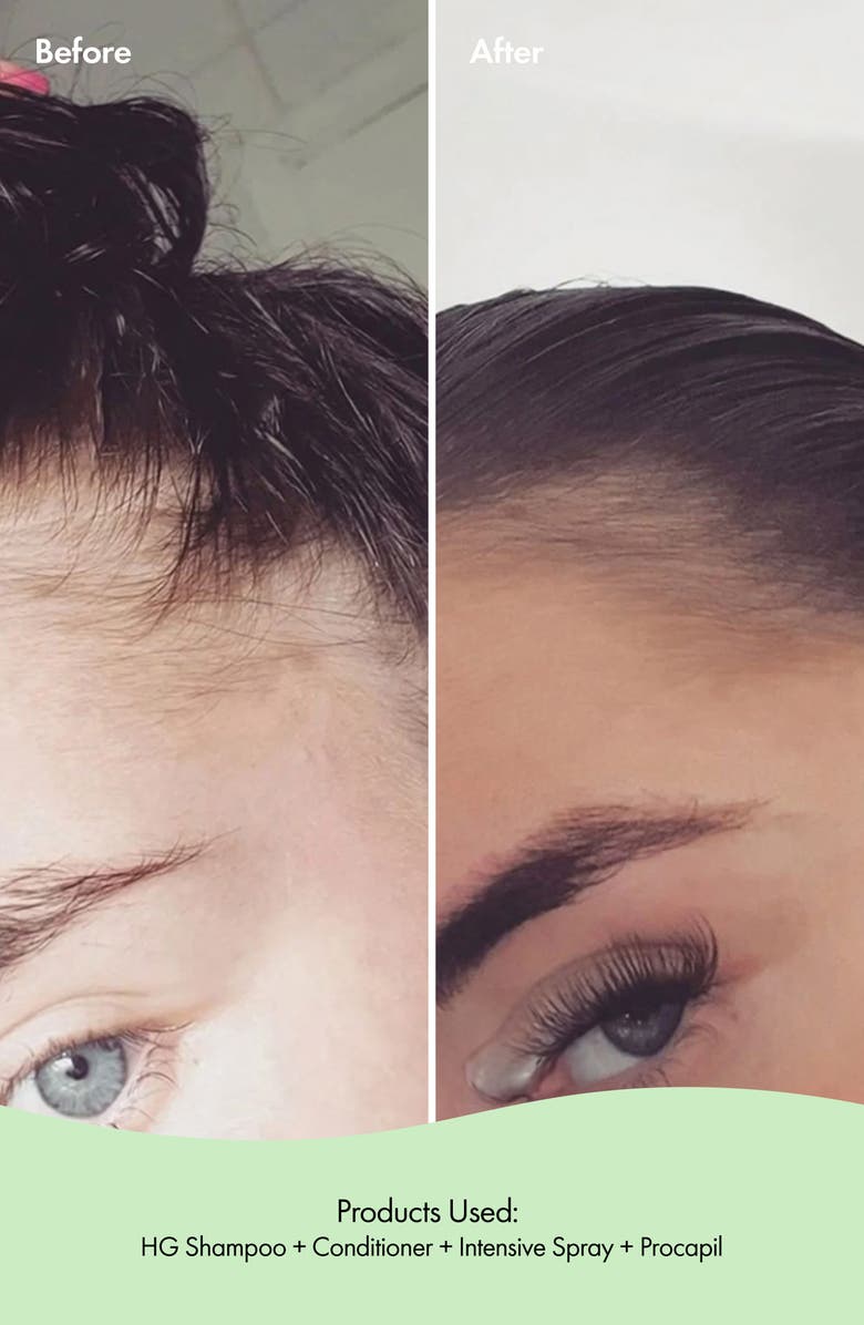 BONDI BOOST Intensive Growth Spray, Alternate, color,