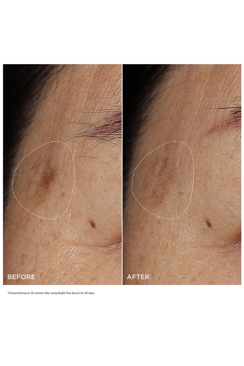 Bright Plus Brightening Vitamin C & Niacinamide Dark Spot Serum, Alternate, color, NO COLOR