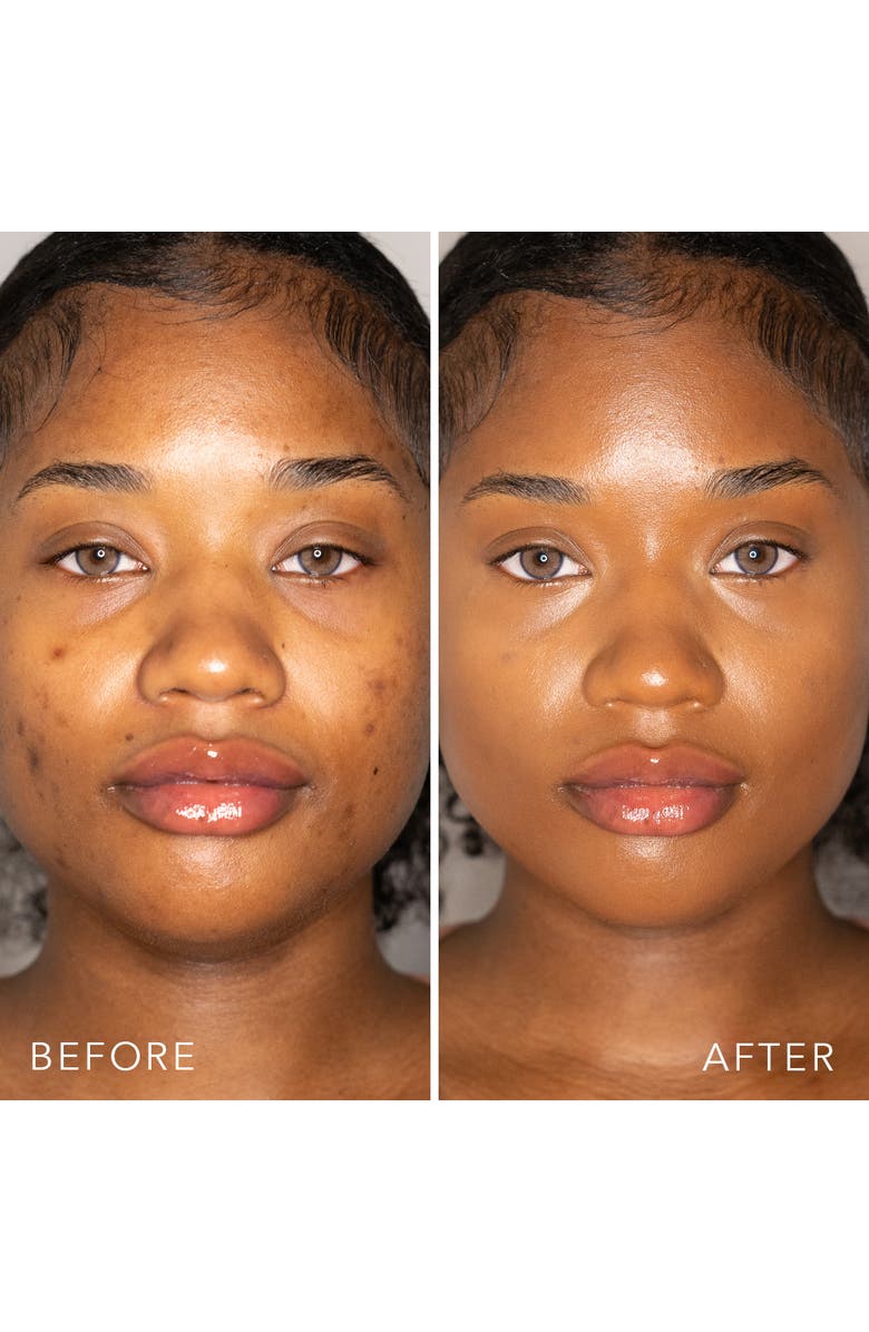 Doll 10 Beauty Doll Skin Genius Serum Concealer with Reishi Mushroom, Alternate, color, Rich