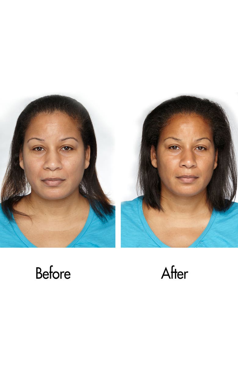 Keranique Follicle Boosting Serum, Alternate, color,