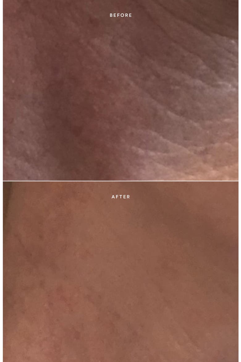 Renew Repair Serum, Alternate, color, NO COLOR