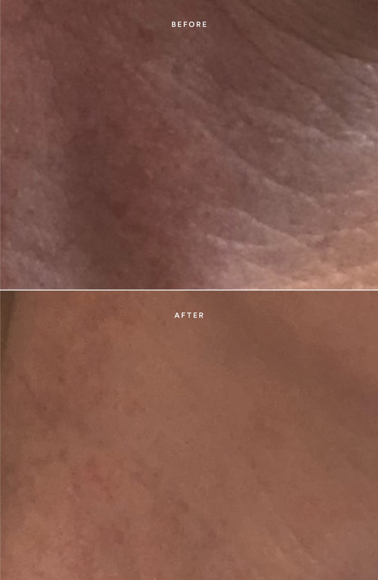 True Botanicals Renew Repair Serum, Alternate, color, 