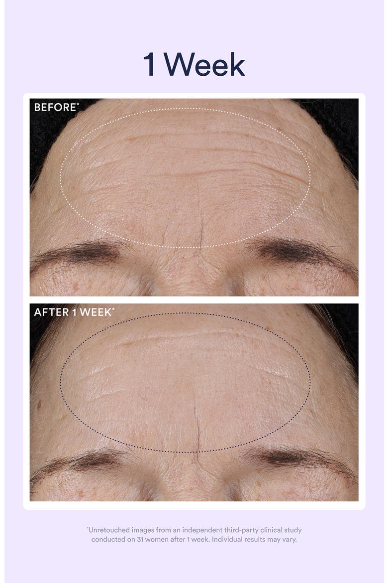 Dream Night Serum with Bio-Retinol, Alternate, color, NO COLOR