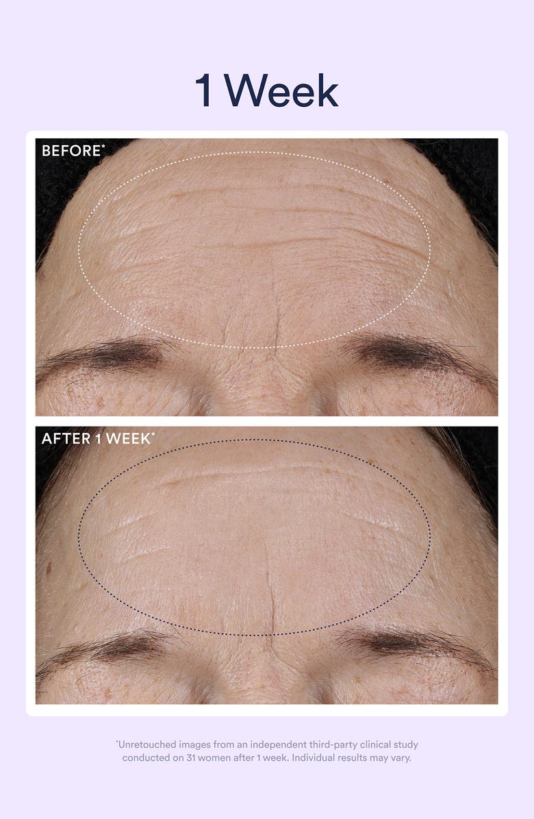 OSEA Dream Night Serum with Bio-Retinol, Alternate, color, 