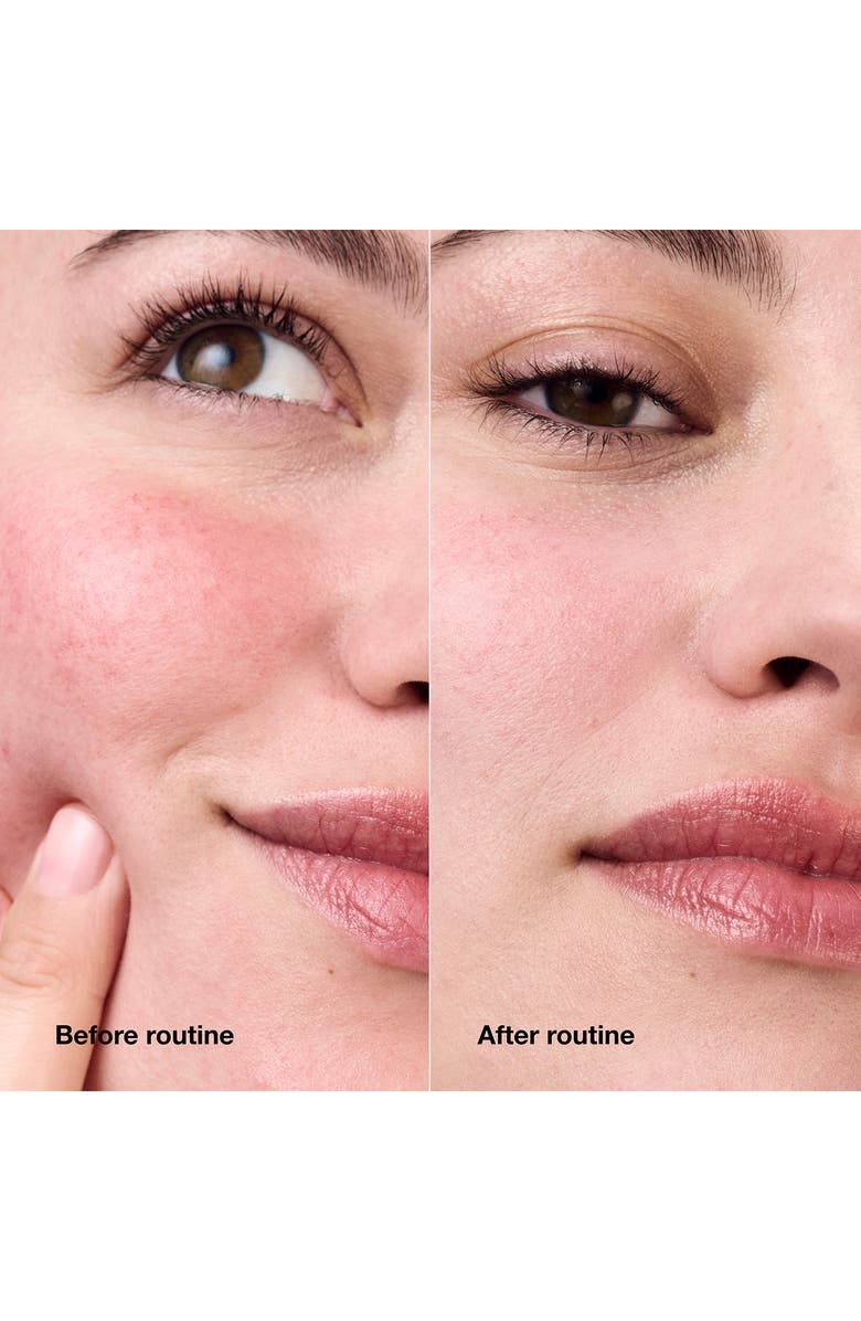 Clinique Redness Solutions Set, Alternate, color, 