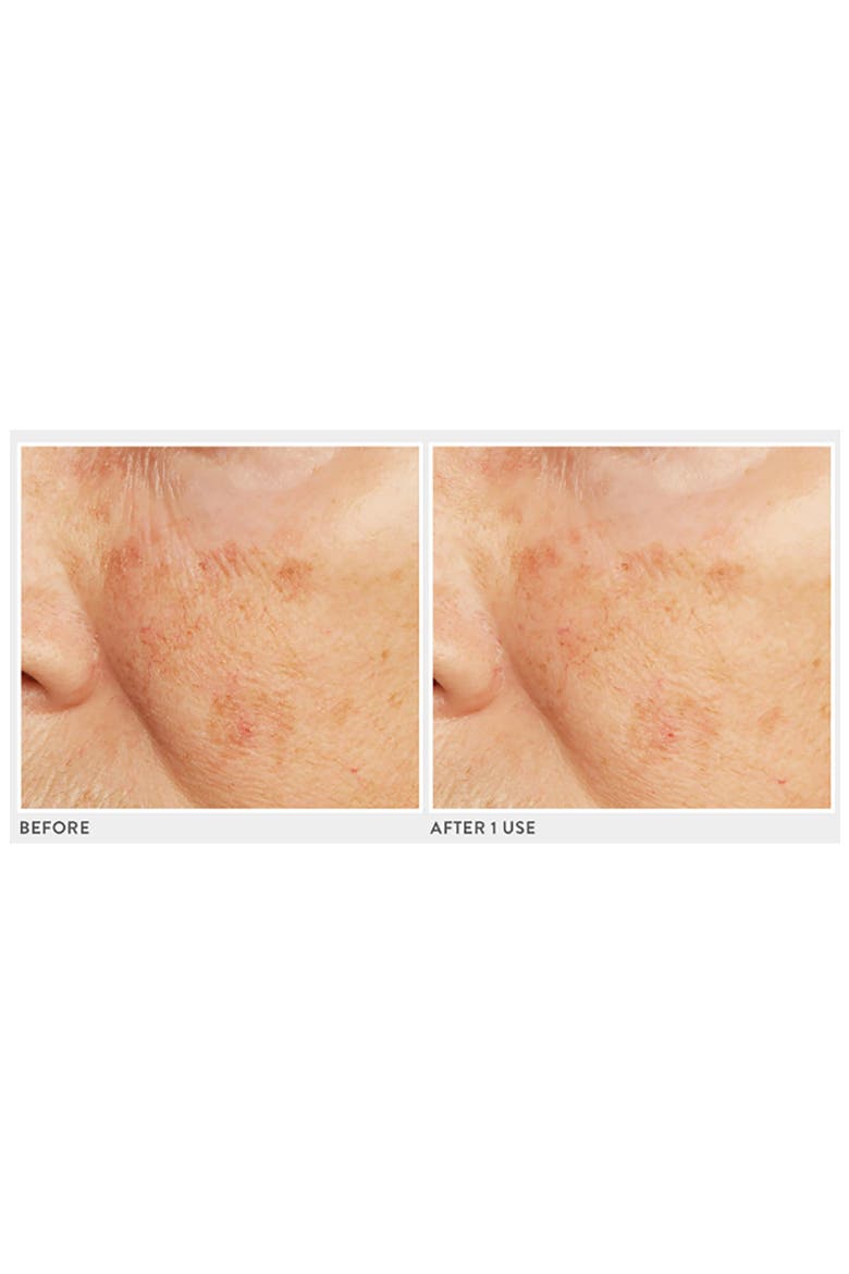Caviar Lime Acid Peel, Alternate, color, NO COLOR