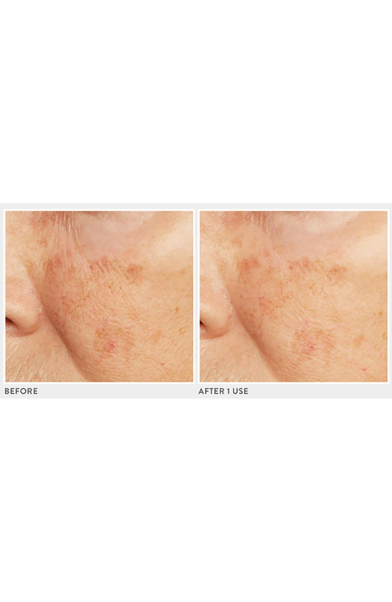 LANCER Skincare Caviar Lime Acid Peel, Alternate, color, 