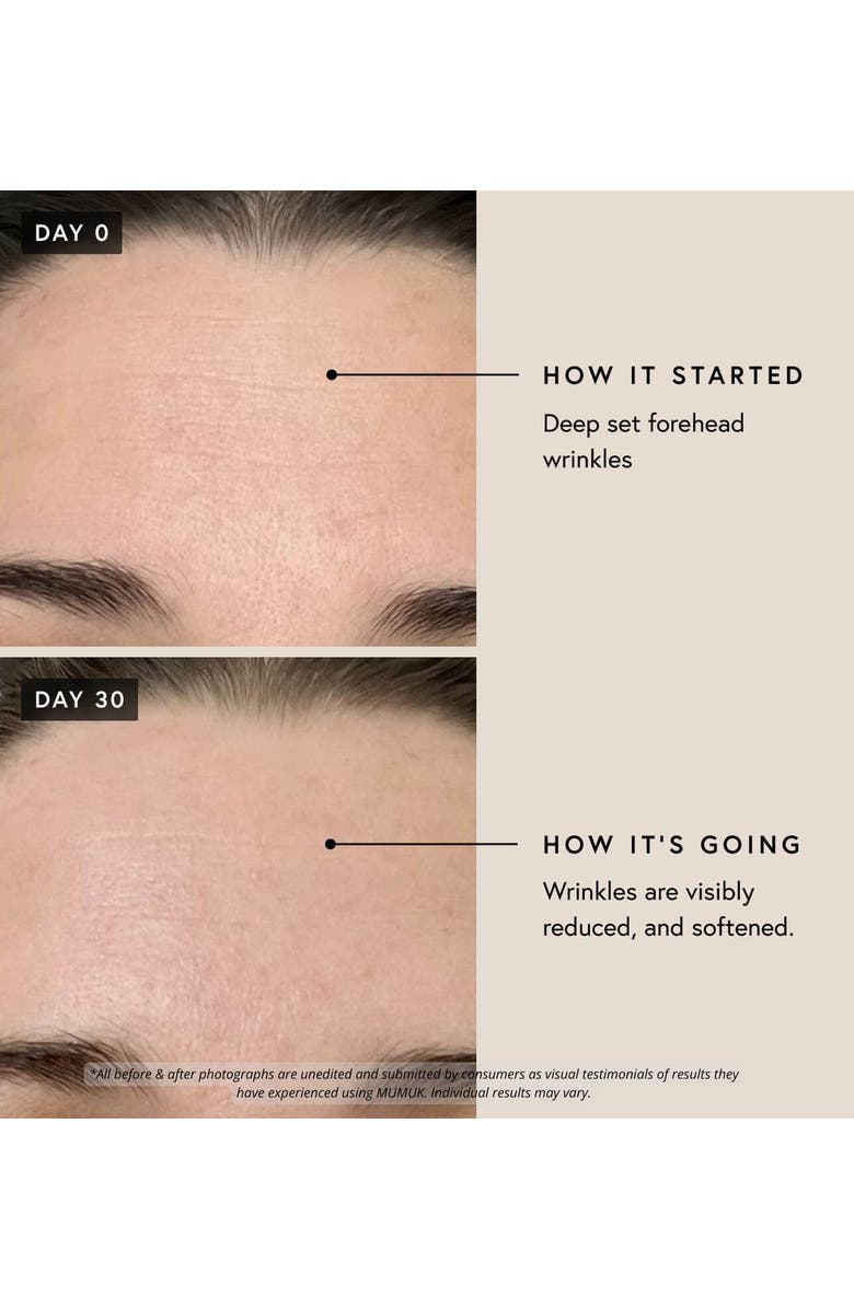 Mumuk Regenerative Complex, Alternate, color, White