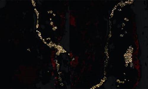 Desigual Marbleized Metallic Overalls In Black