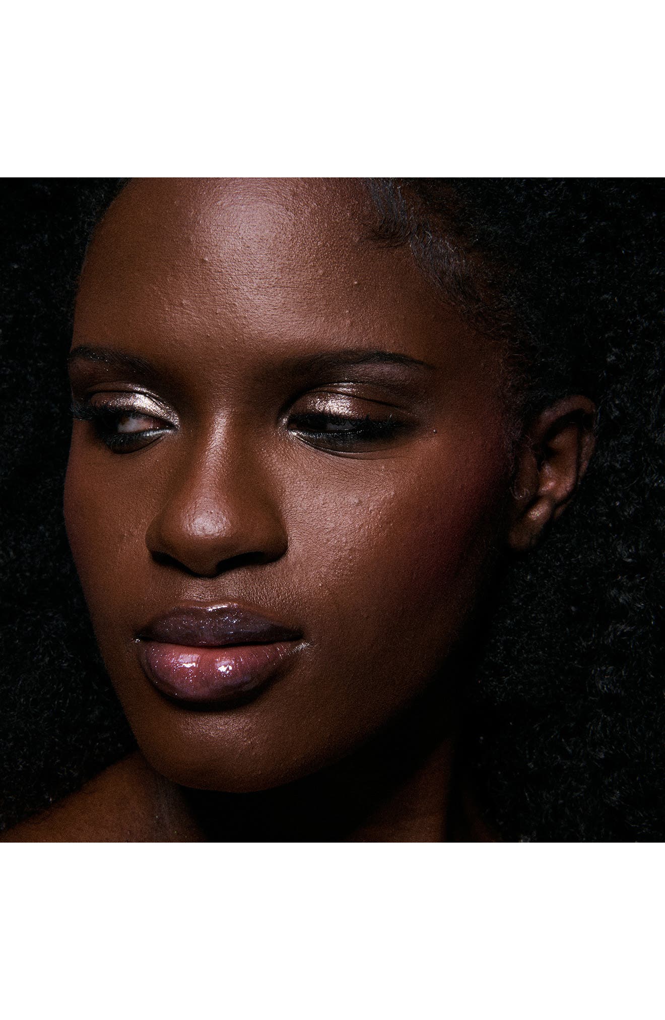 is labial melanotic macule dangerous Freckle on Lip: Meaning, Causes and Is It Dangerous? (Labial Melanotic  Macule)  La Bouche Parfaite